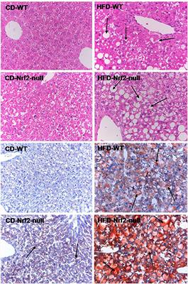 High Fat Diet-Induced Hepatic 18-Carbon Fatty Acids Accumulation Up-Regulates CYP2A5/CYP2A6 via NF-E2-Related Factor 2